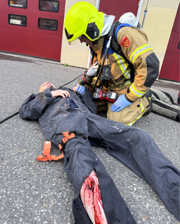 High-fidelity open fracture simulation &mdash; SIMWIS product
